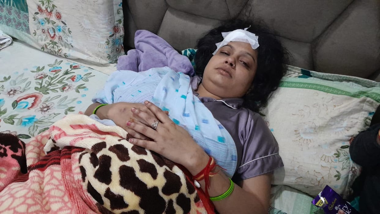 Attempted robbery at businessman's house with fake pistol, wife injured
