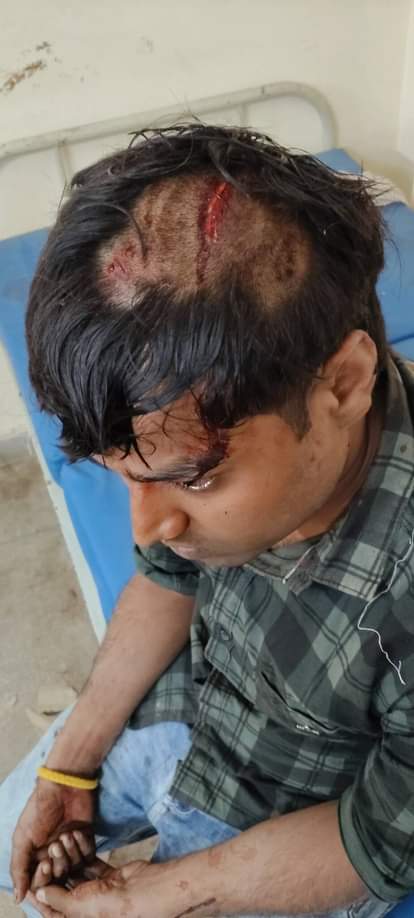 Electricity contractor assaulted