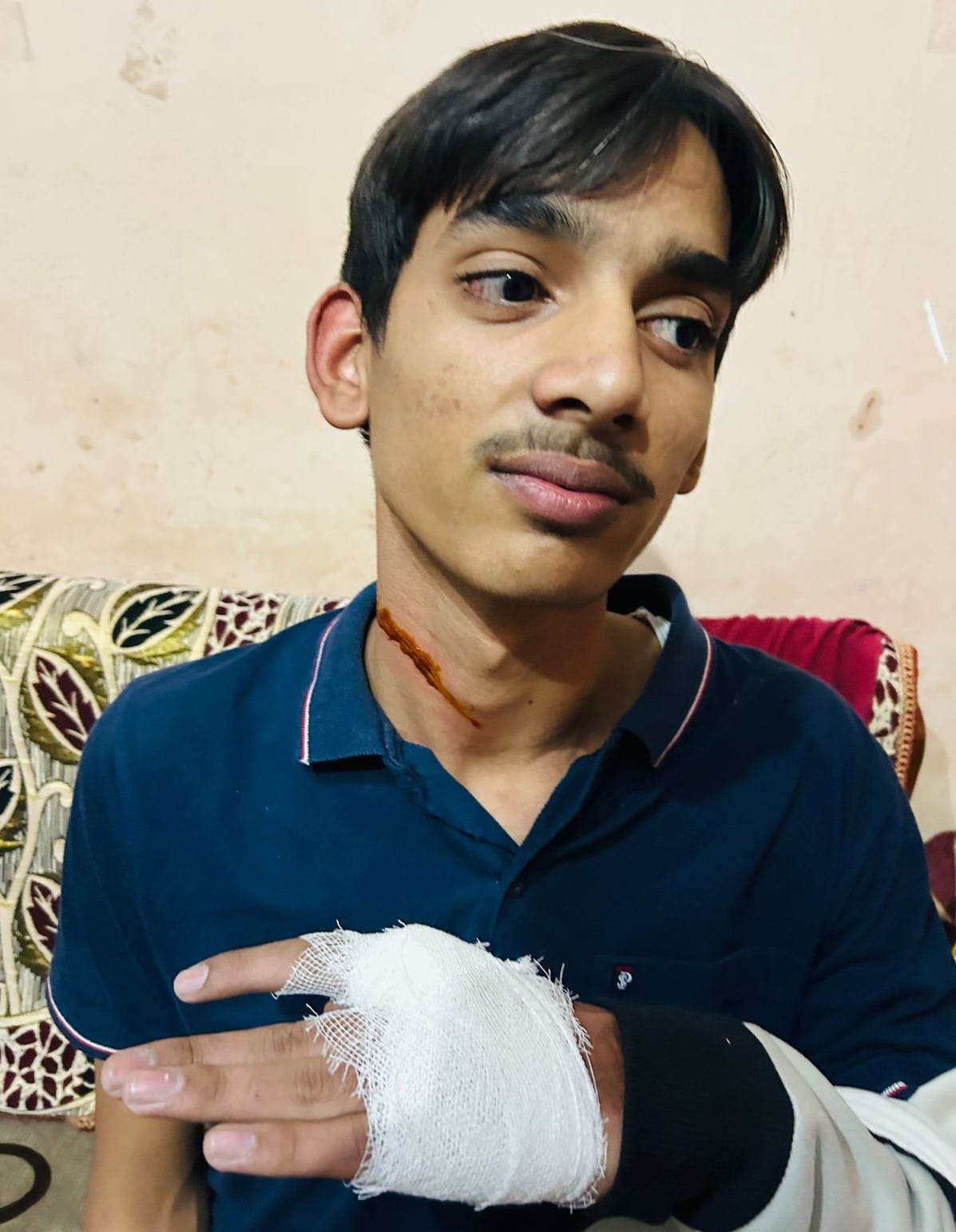 Student returning home from coaching injured by Chinese manjha
