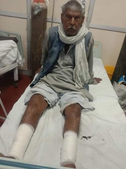 Uncle and nephew standing at the edge of the field were hit by a bike and injured.