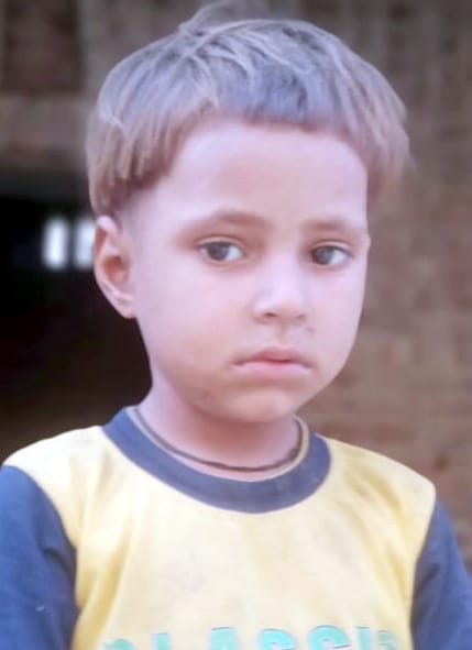 A girl died after eating Jatropha fruit, two others were in critical condition.