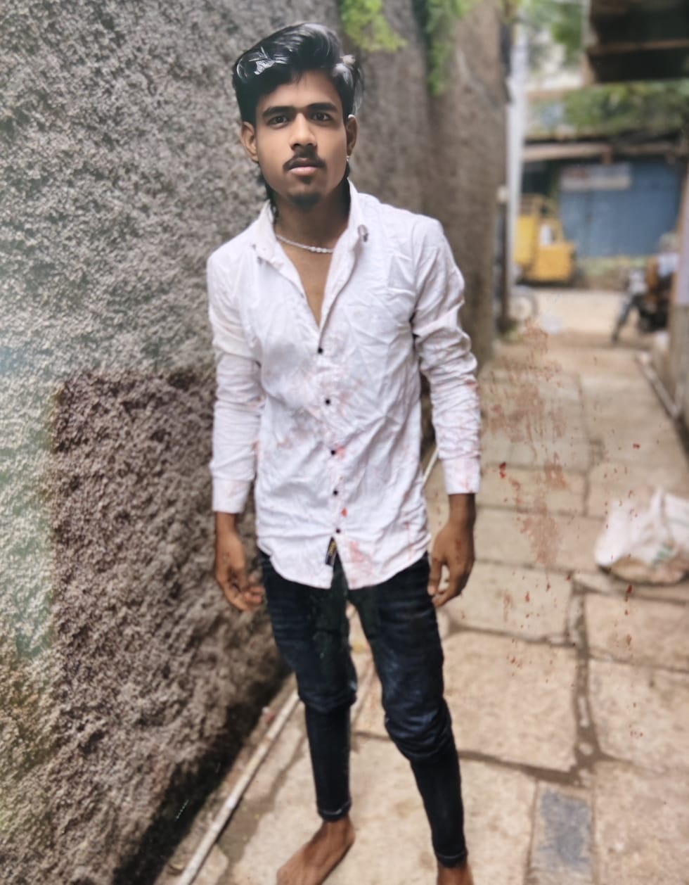 Brother riding a bike to attend sister's Tilak ceremony dies in an accidentBrother riding a bike to attend sister's Tilak ceremony dies in an accident