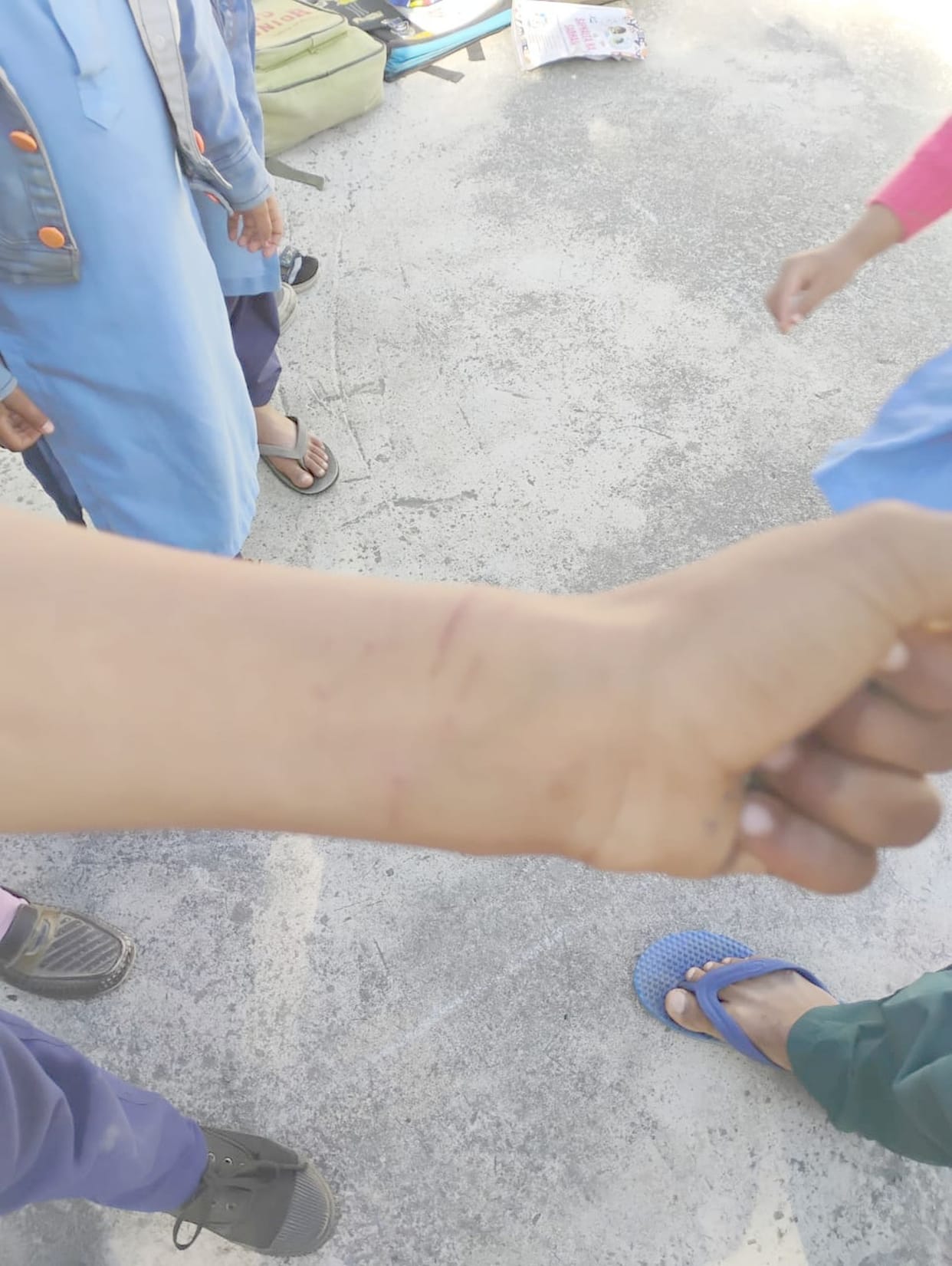 Wild animal pounces on children in Kund school, scratches one
