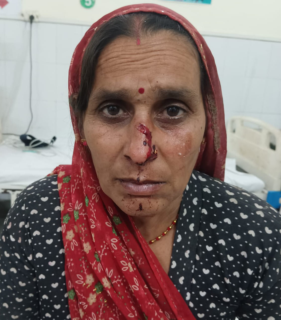 Woman's nose broken with a stick, beaten after being thrown to the ground