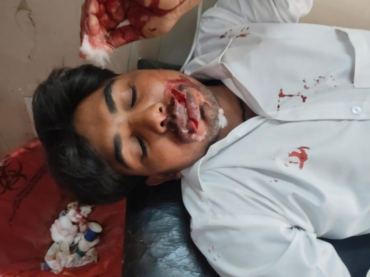 Bike rider's manja gets stuck in his neck, lips cut