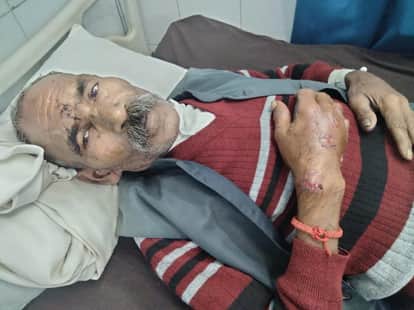 Elderly man attacked by jackal while sleeping, beaten to death by villagers