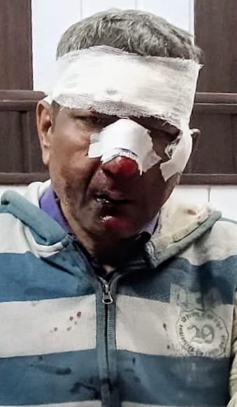Two bike riders injured after bike tyre burst