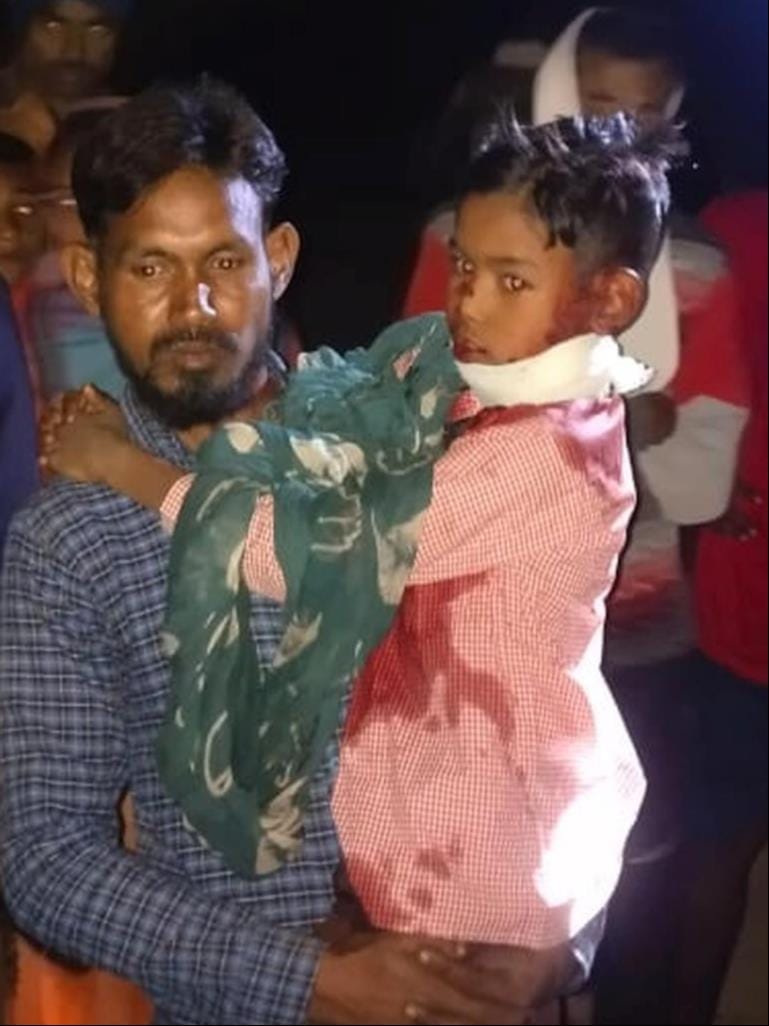 Woman killed, child critical in leopard attack