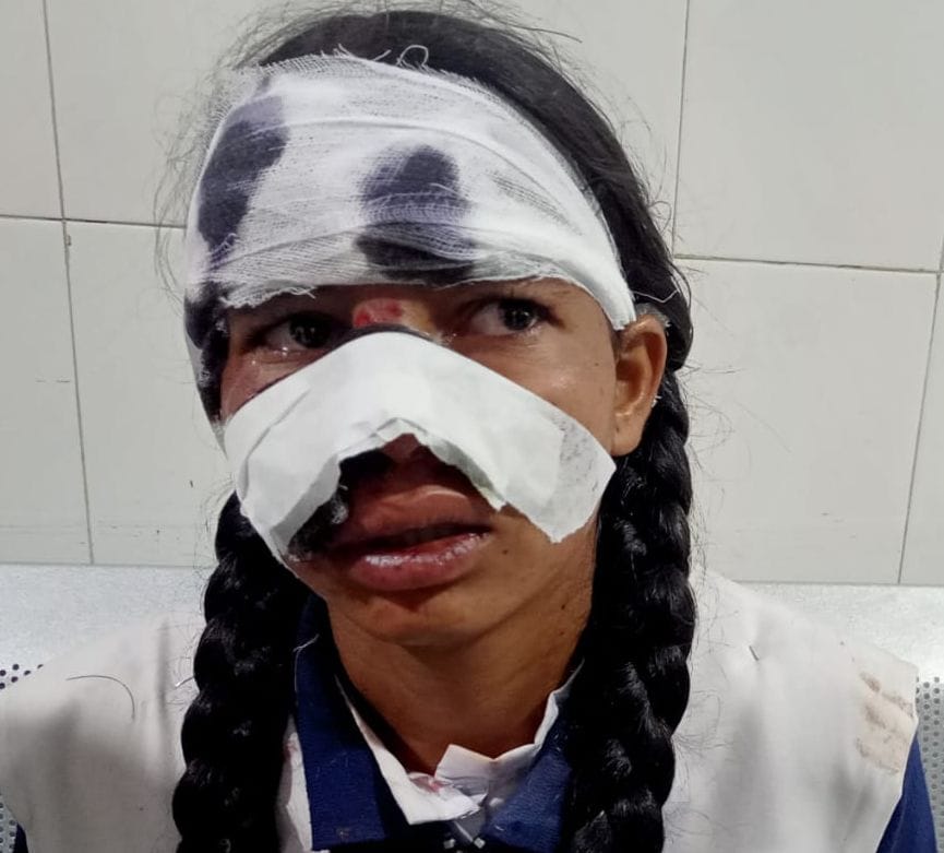 Intermediate student injured in monkey attack
