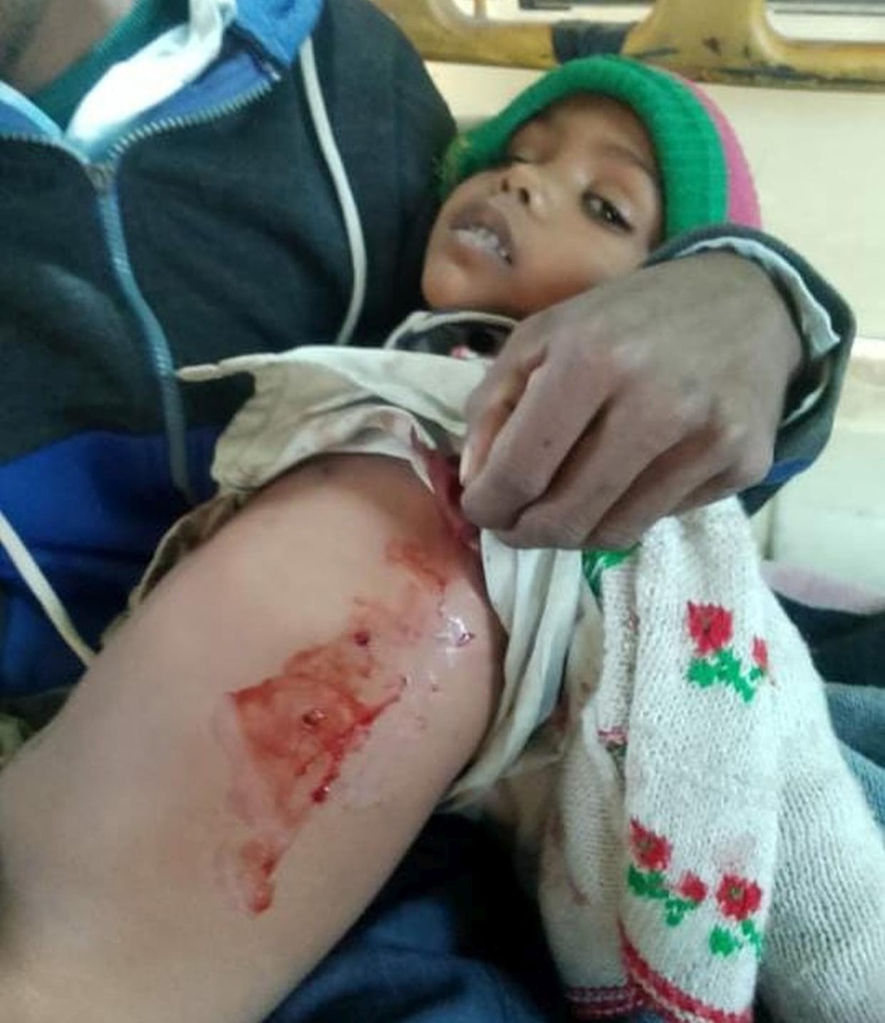 Wolves attack in Sangwa village, girl and goat injured