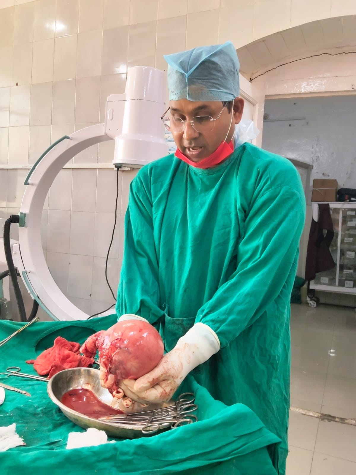 A five-kilogram tumor was removed from a woman's uterus
