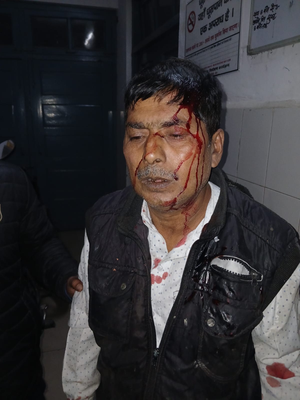 The cart owner was beaten and injured