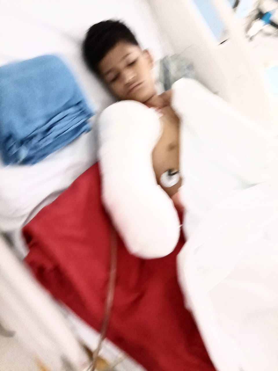 An innocent child playing on the roof was hit by a high-tension line and his right hand had to be amputated.