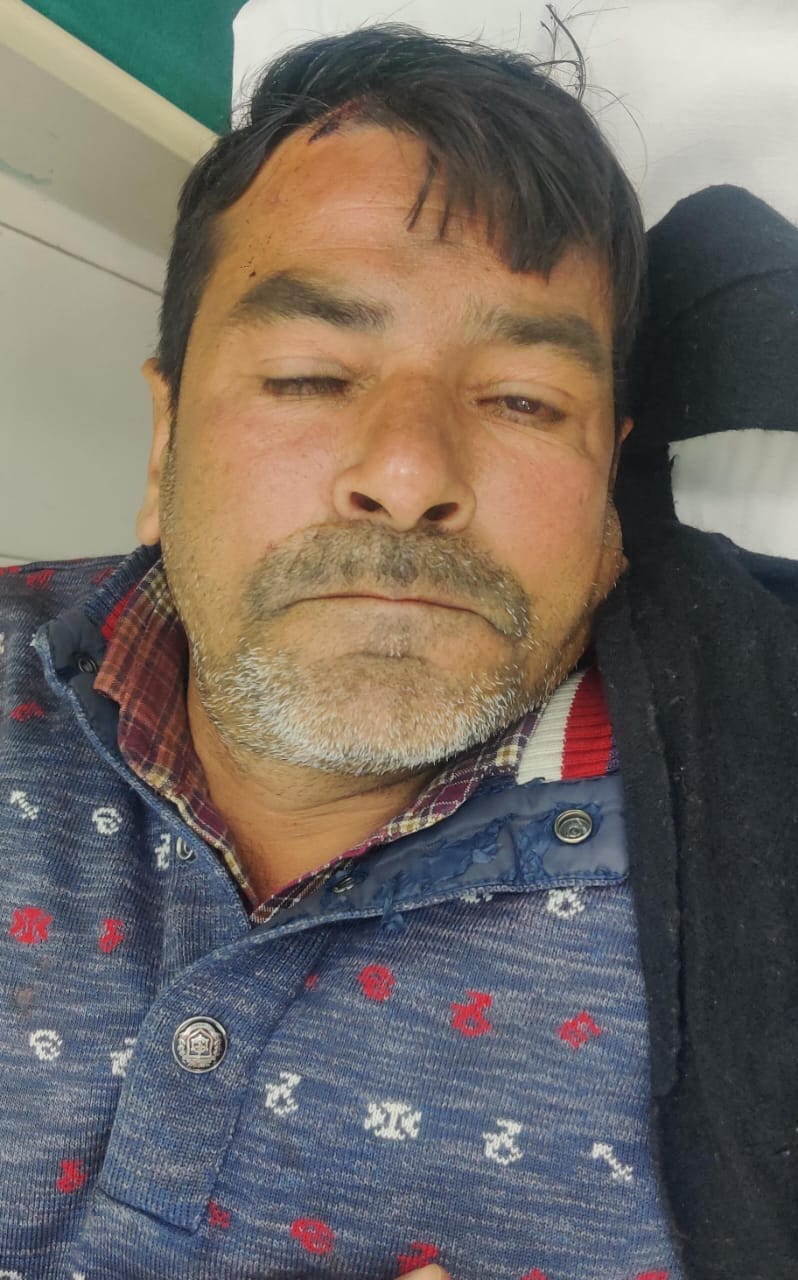 A deadly attack on the agent after an argument