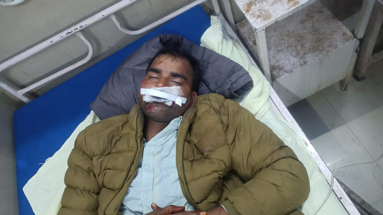 The groom, who was going to attend a wedding in Nikrausi, had his lips cut by a Chinese manjha.