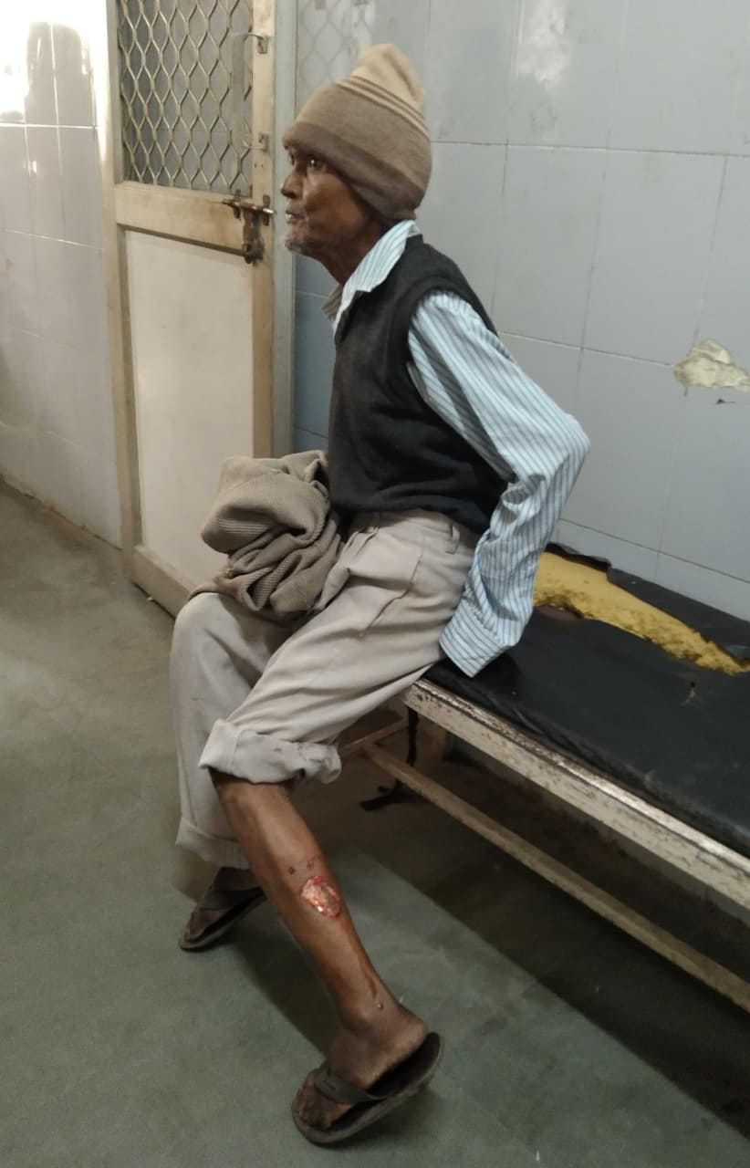 Elderly man selling vegetables bitten by dog