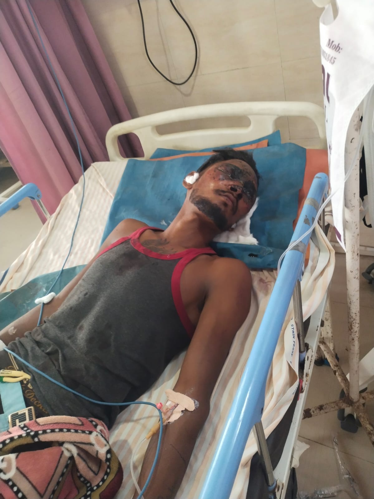 Explosion while making homemade bomb, youth injured, condition critical