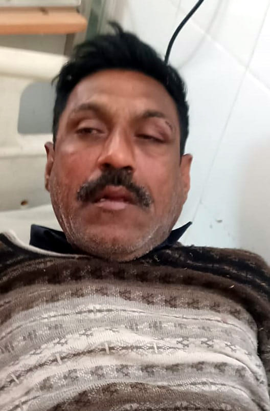 agra news bah poison army man