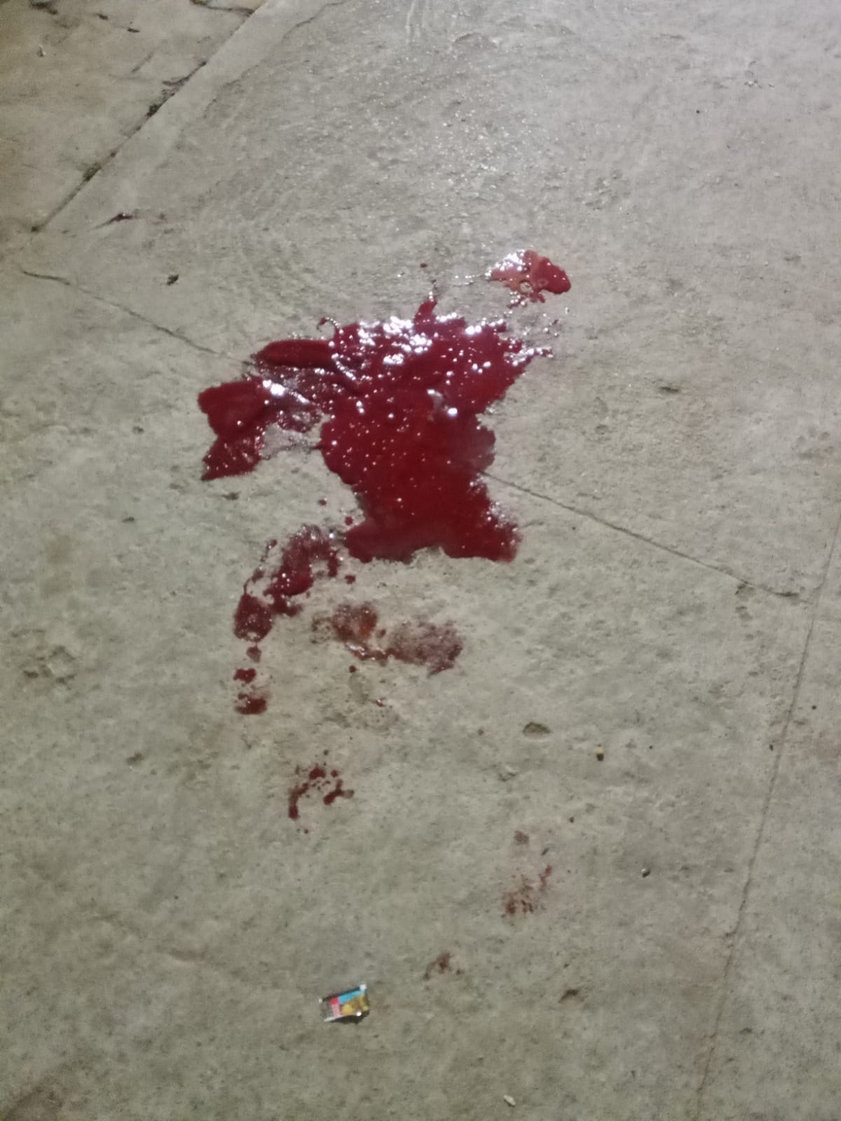 No stretcher available, delivery at hospital gate