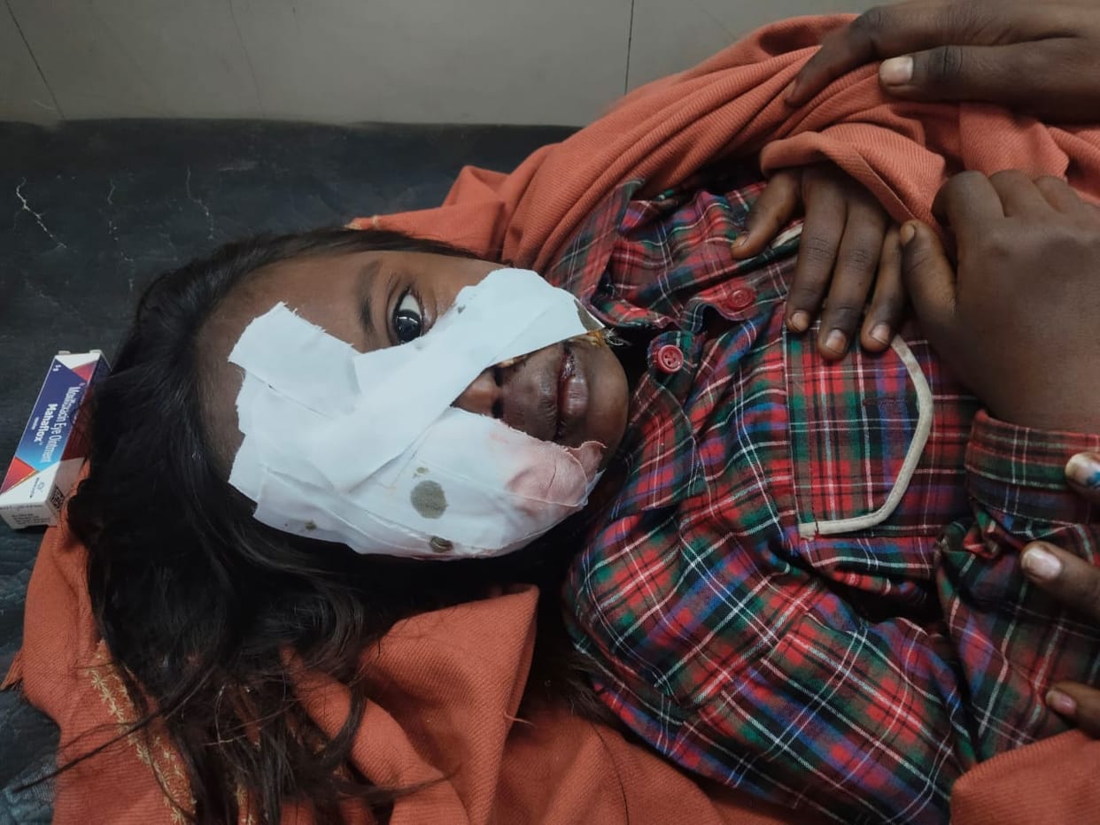 Girl injured in dog attack, referred to Lucknow