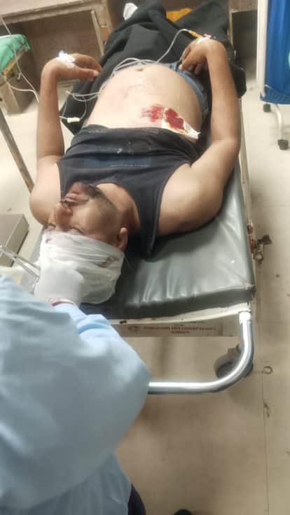 Beawar News: Contract Driver of Police Vehicle Shot in Chest After Attack, Police Launch Hunt for Accused