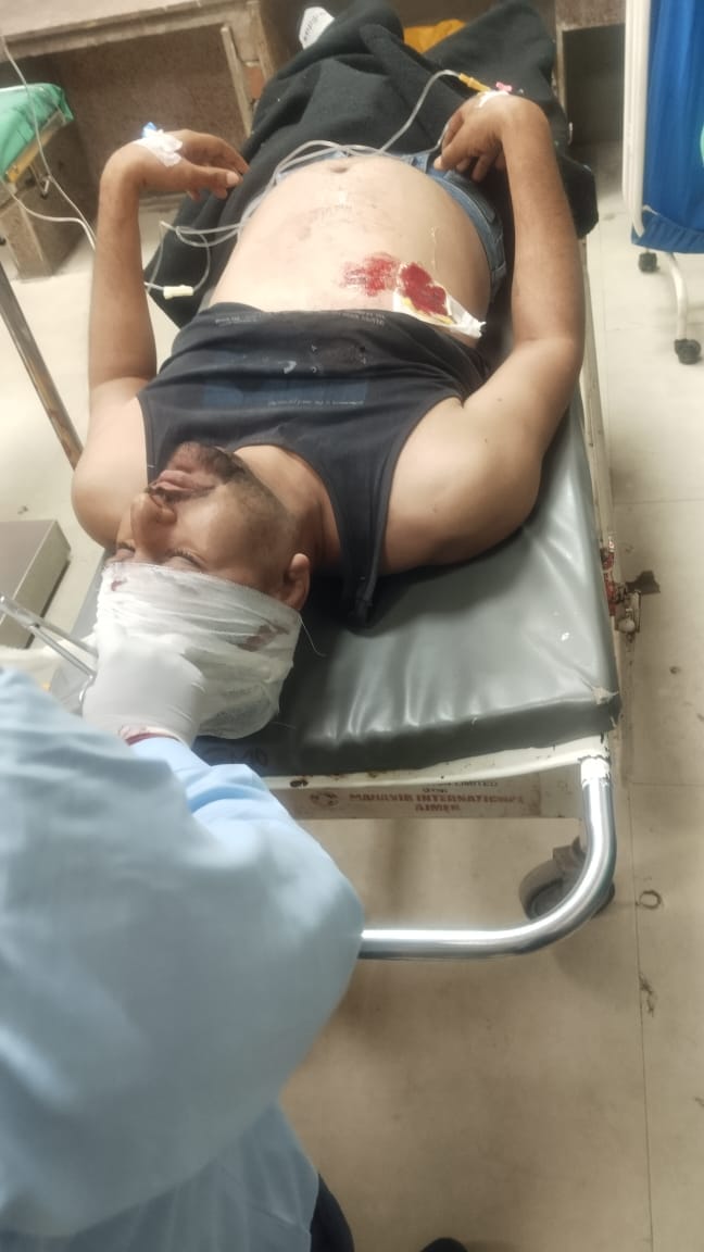 ब्यावर में पुलिस गाड़ी के संविदा ड्राइवर पर हमला