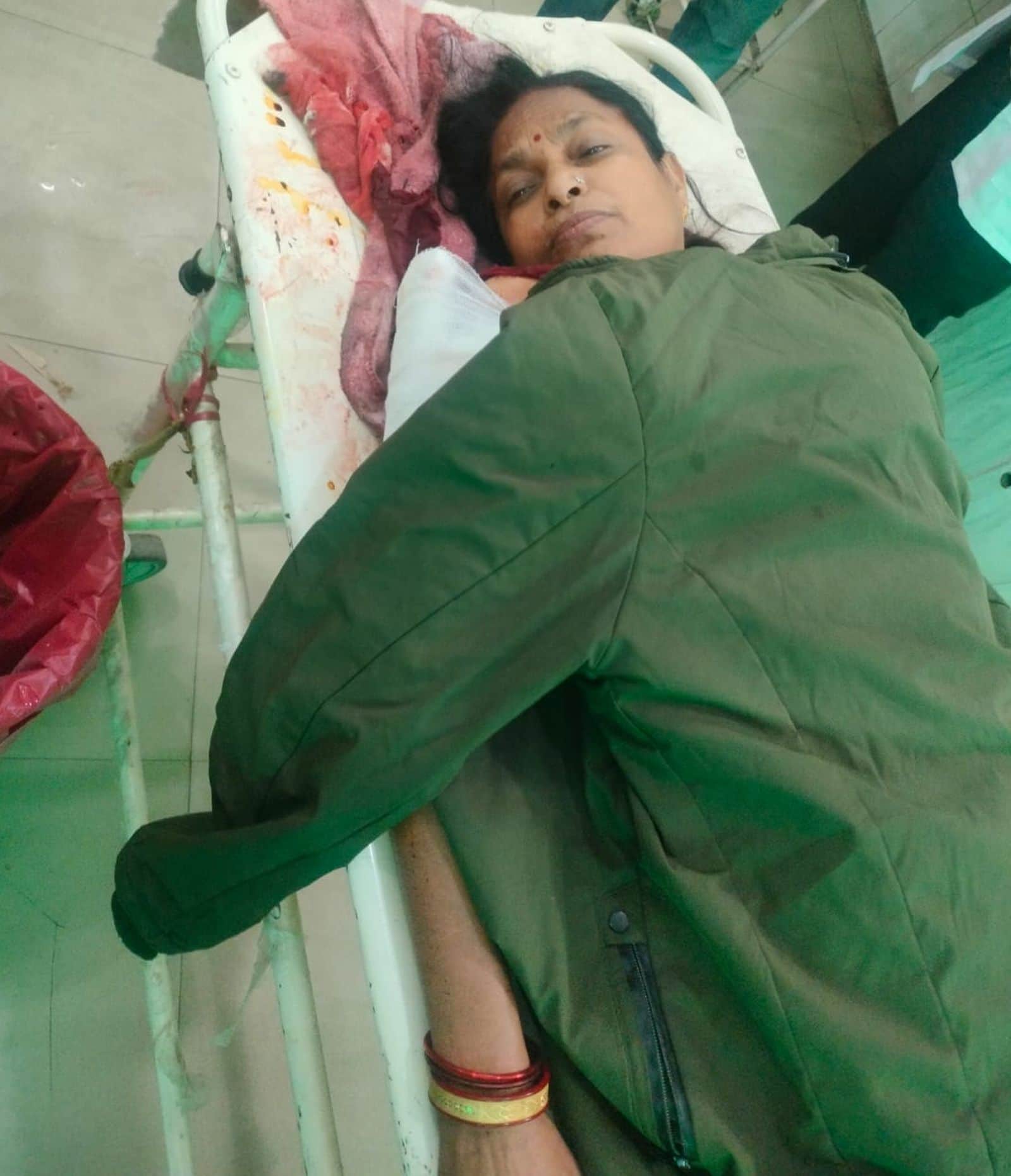 जिला अस्पताल में भर्ती गोली लगने से घायल प्रवेश देवी ।संवाद