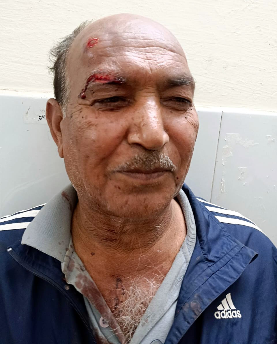 Former soldier stoned for not giving him a match to light a cigarette, escapes home