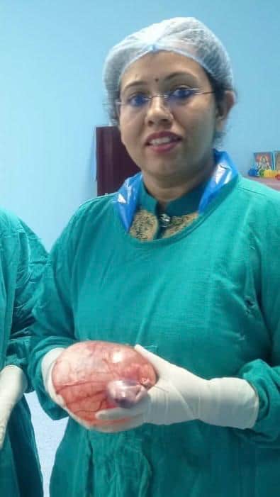 Doctors removed a one-kilogram tumor from the woman's abdomen through surgery, restoring the patient's smile.
