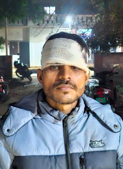 घायल अजीत गुप्ता।संवाद