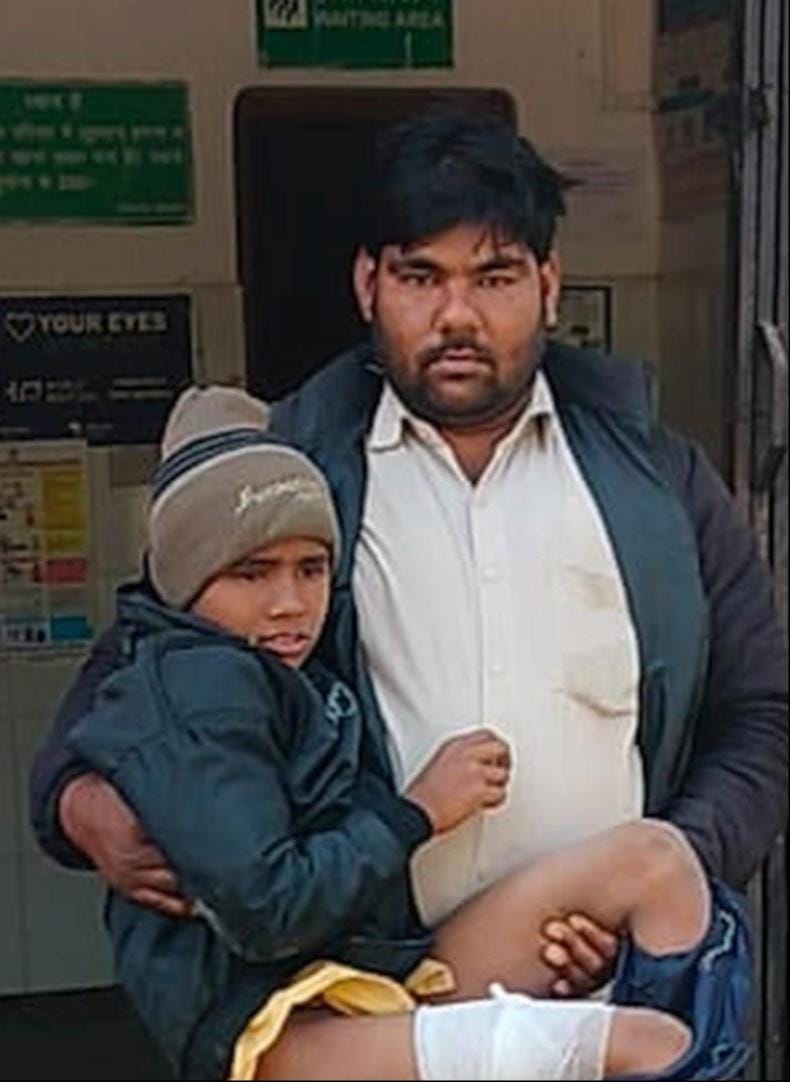 Dog scratched and injured child