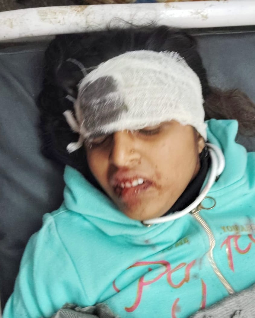 Seven people, including a young girl and a teenage girl, were injured in accidents caused by fog.
