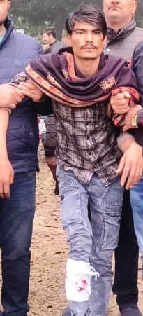Cow slaughterer carrying a reward of Rs 20,000 injured in encounter