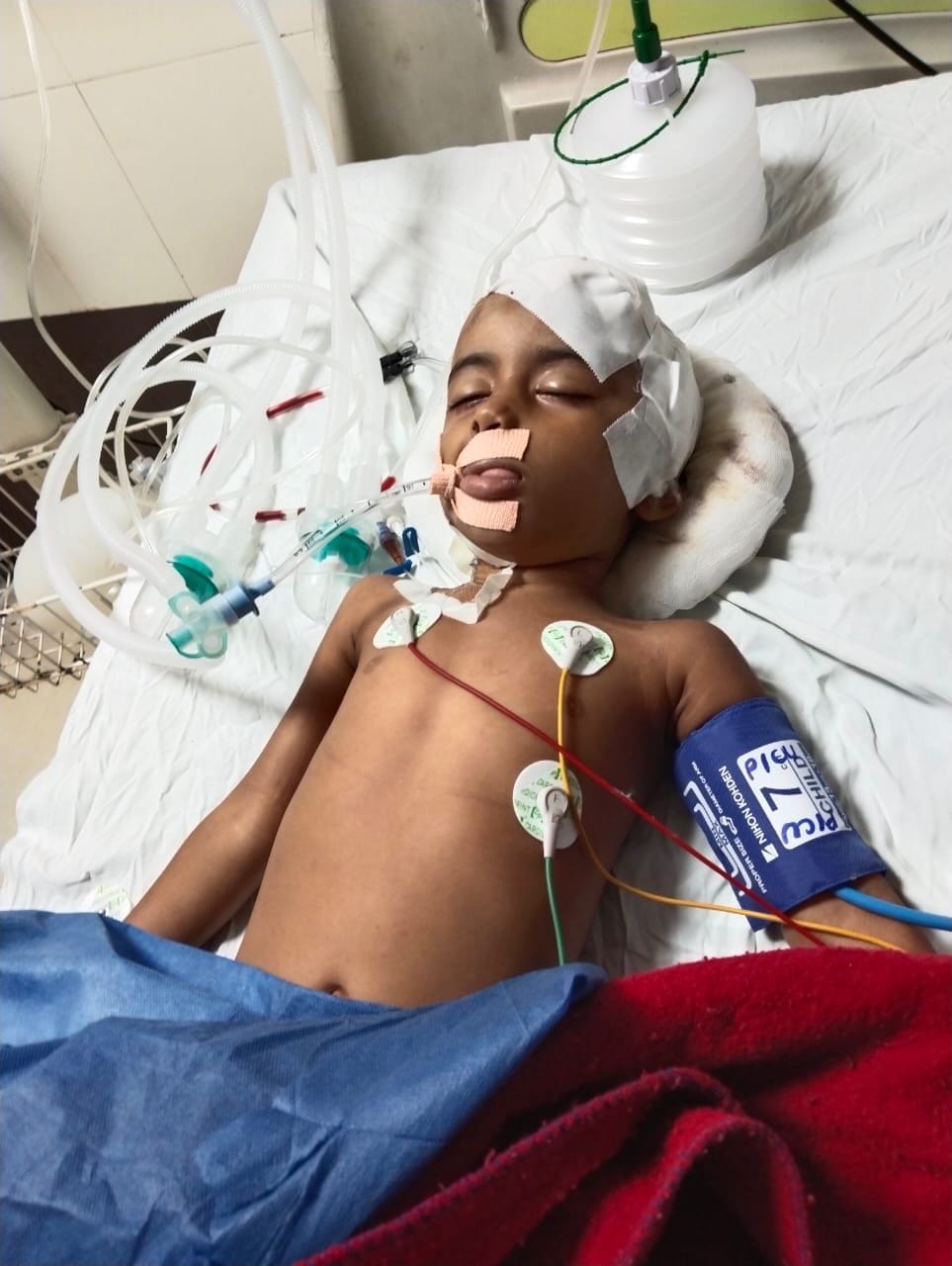 A girl playing on the roof was shot in the head; it is not known where the bullet came from