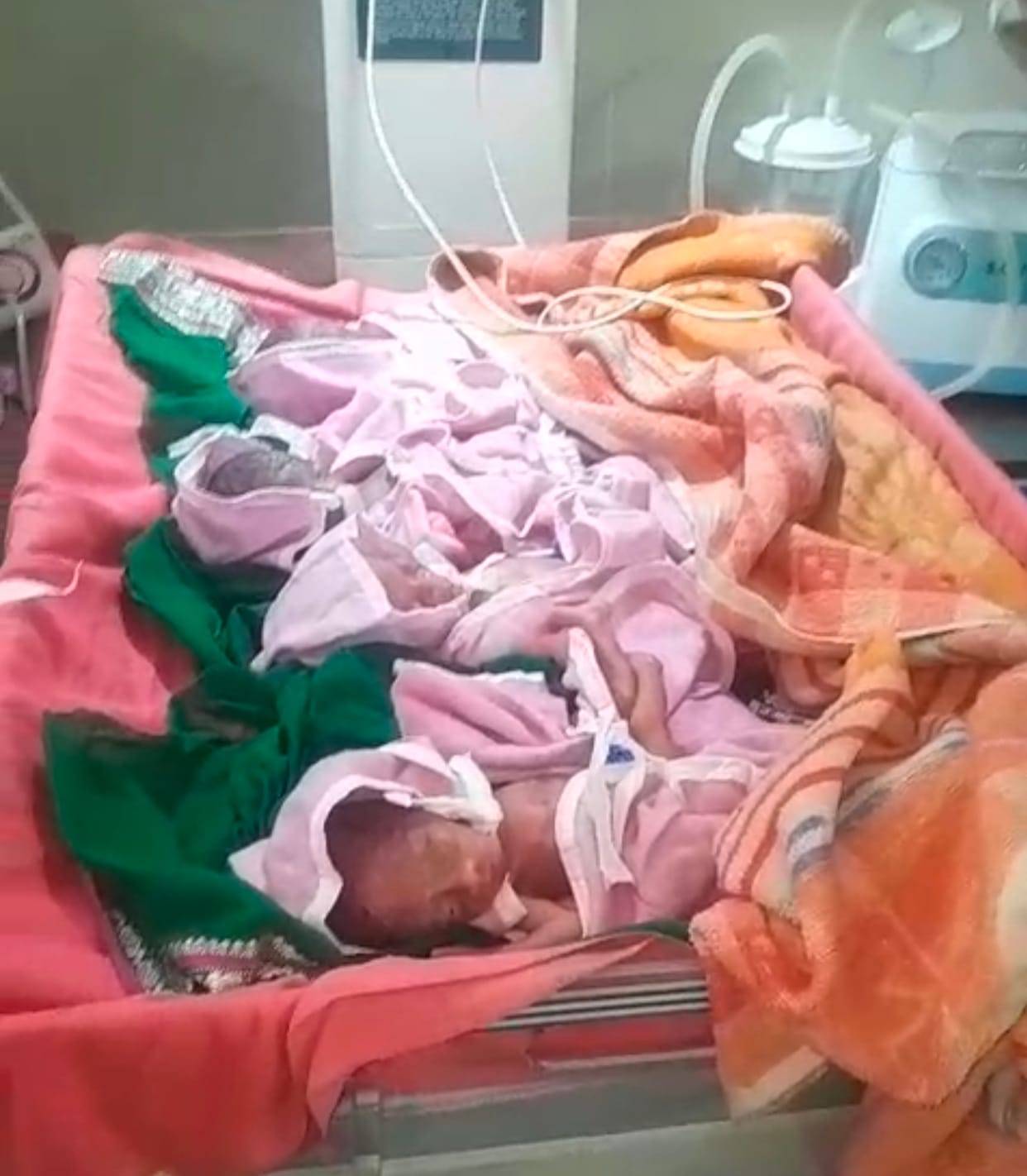 Chhindwara News: Woman gives birth to quadruplets in Junnardeo, one newborn in critical condition