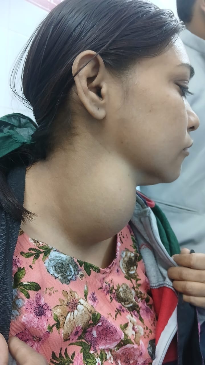 Successful surgery for a 750 gram thyroid lump