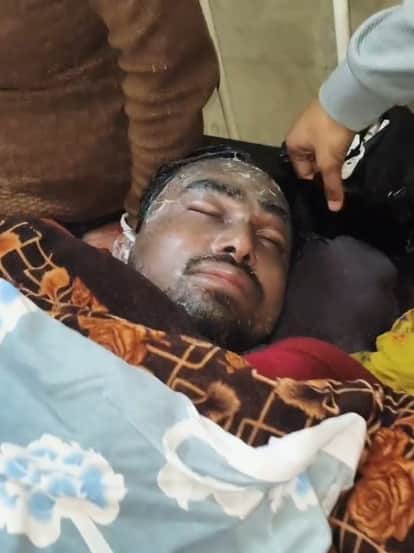 Bettiah bihar news Father pours boiling oil on son condition serious police investigation today news