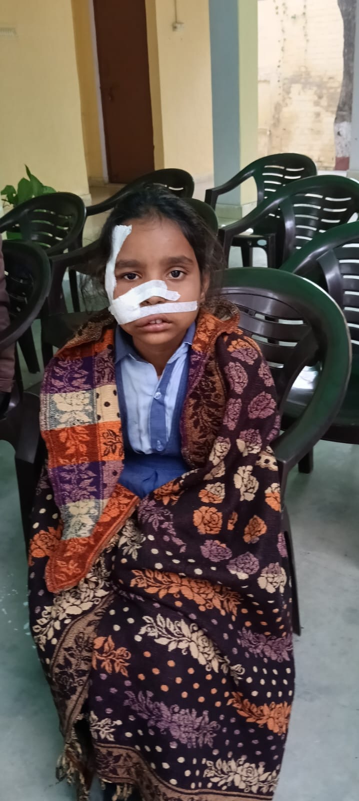 While getting off the school bus, a speeding motorcycle ran over a young child, leaving the child seriously injured.
