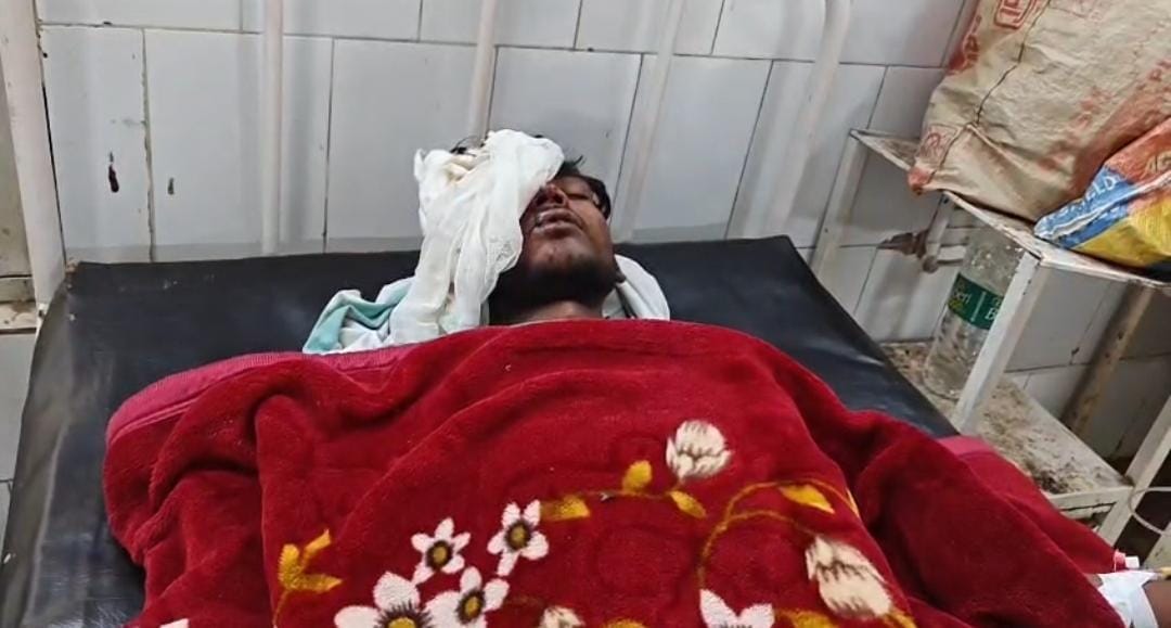 Muzaffarpur Bihar news :fighting in mutual dispute one person eye being burst police investigate