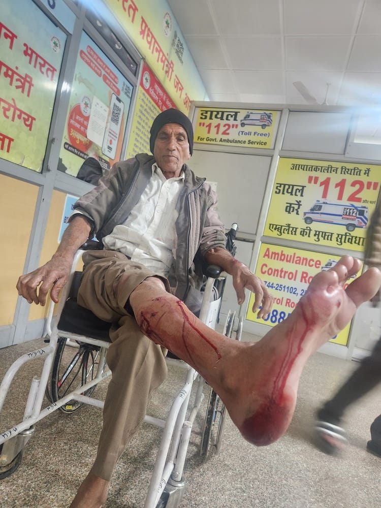Stray dogs bite 10 people, including children, in a single day