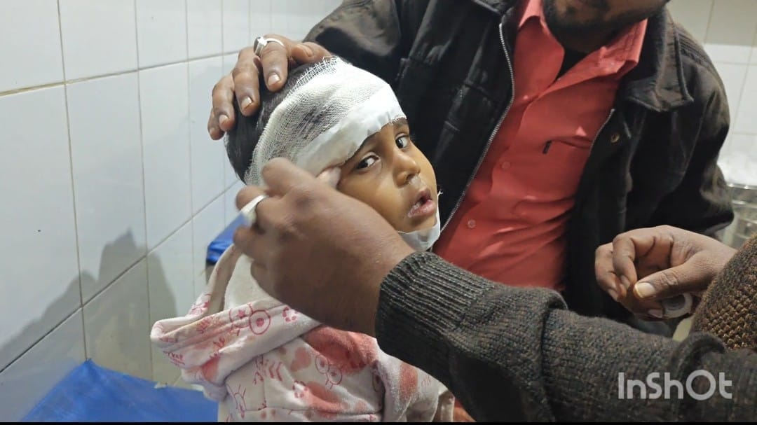 A monkey chased an innocent child and he fell from the roof, receiving three stitches on his head.