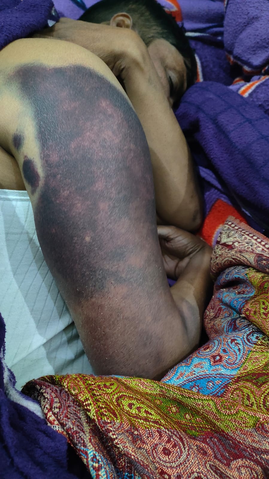 Finance employee beaten up for demanding salary, two arrested.