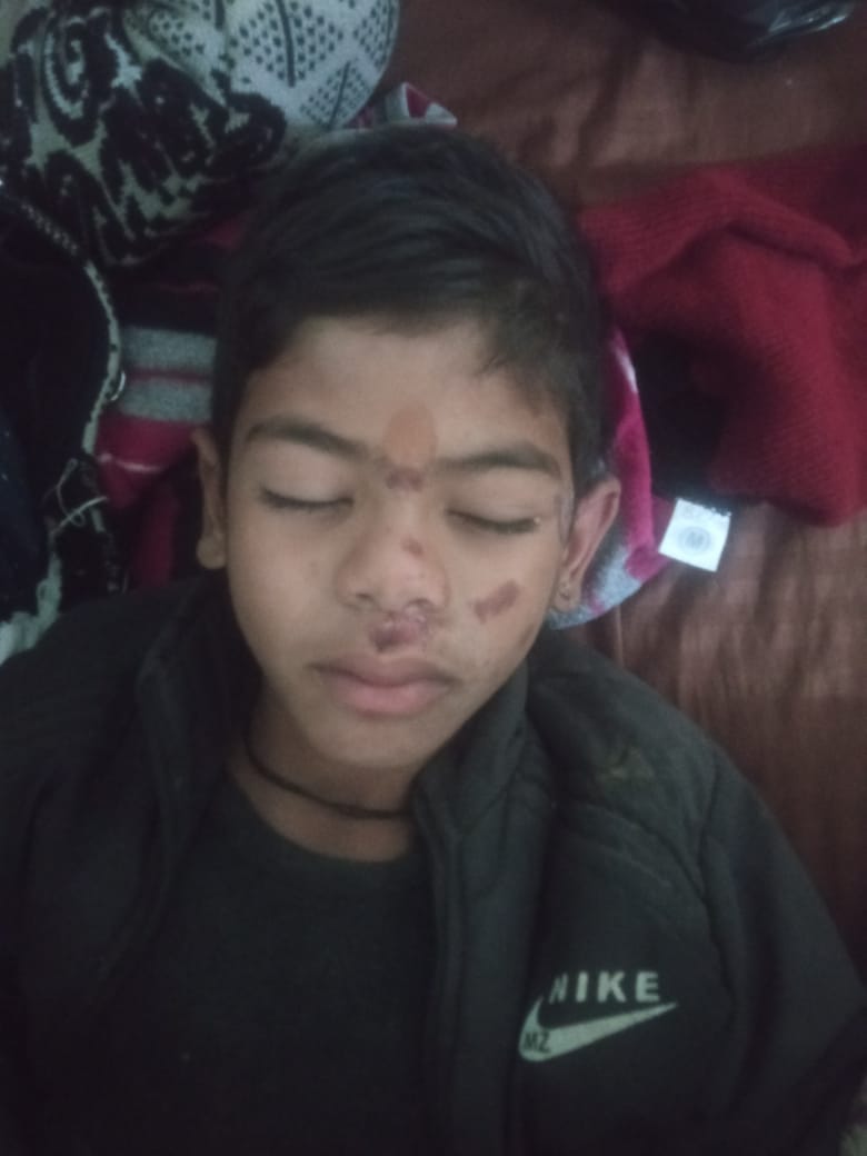 A child standing outside the house was hit by a vehicle and injured.