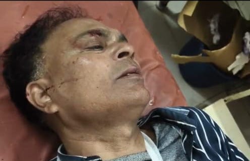 Police was chasing, bike rider crushed by miscreants' car