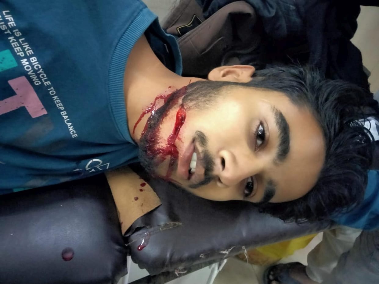 A young man was injured after getting entangled in Chinese thread.