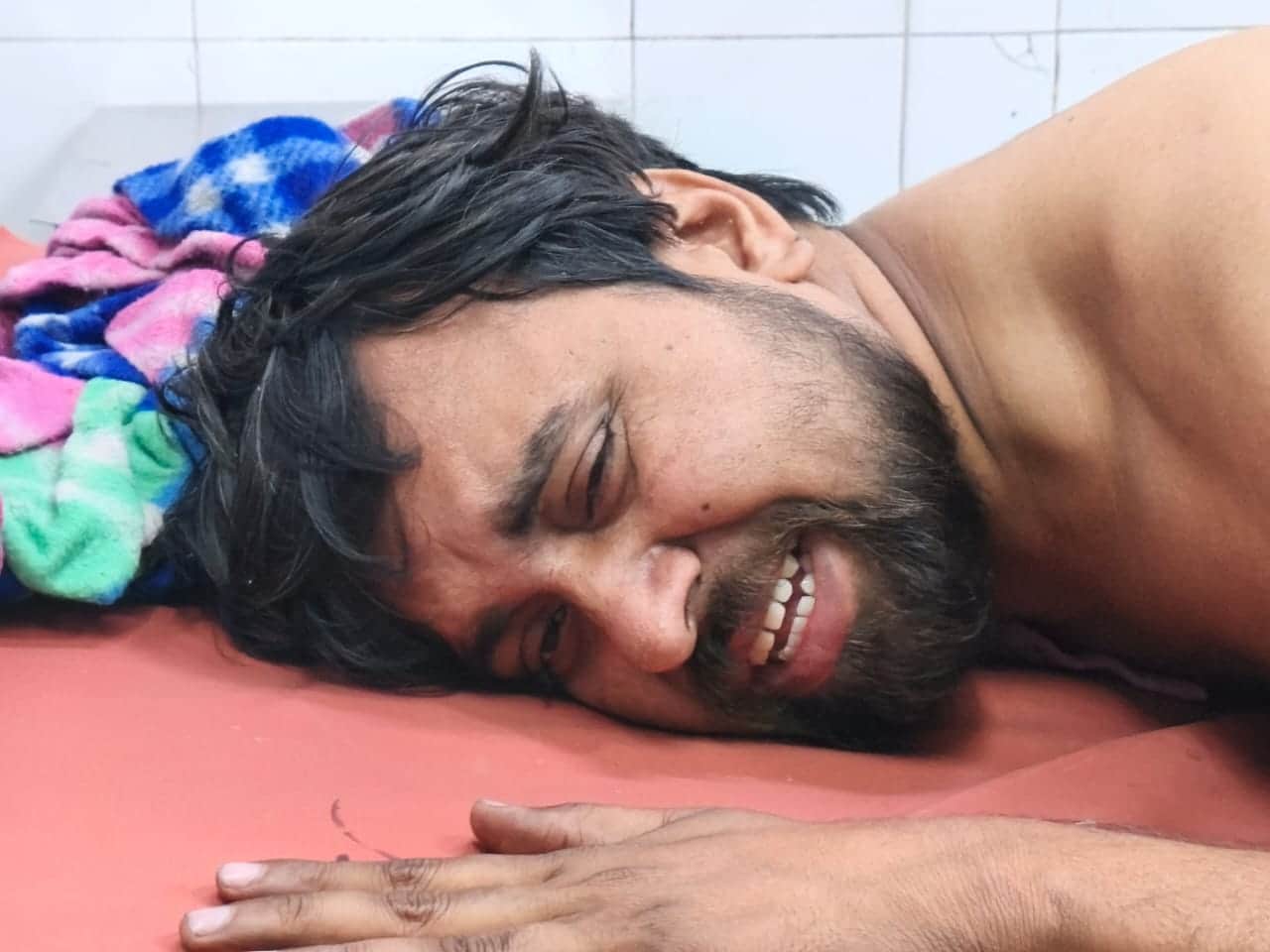 जिला अस्पताल में भर्ती झुलसा युवक। संवाद