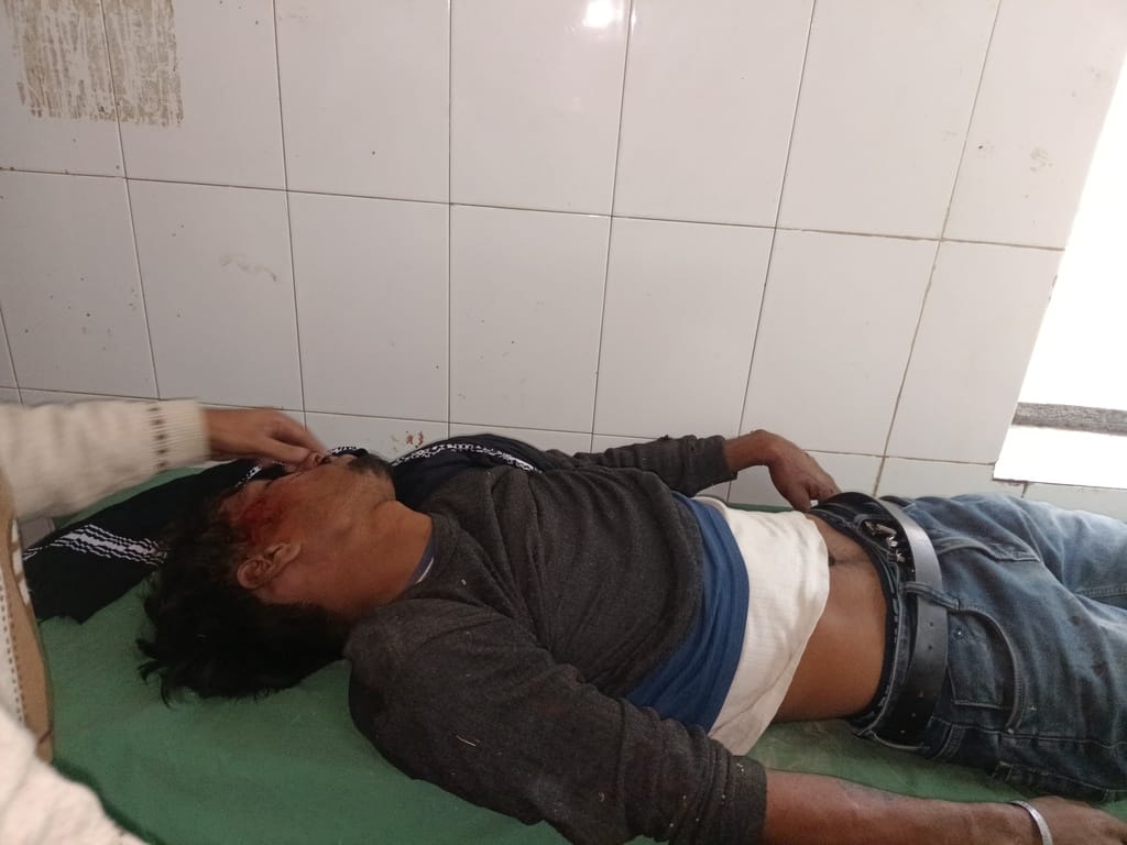 Two bike riders injured in collision with dumper, one seriously