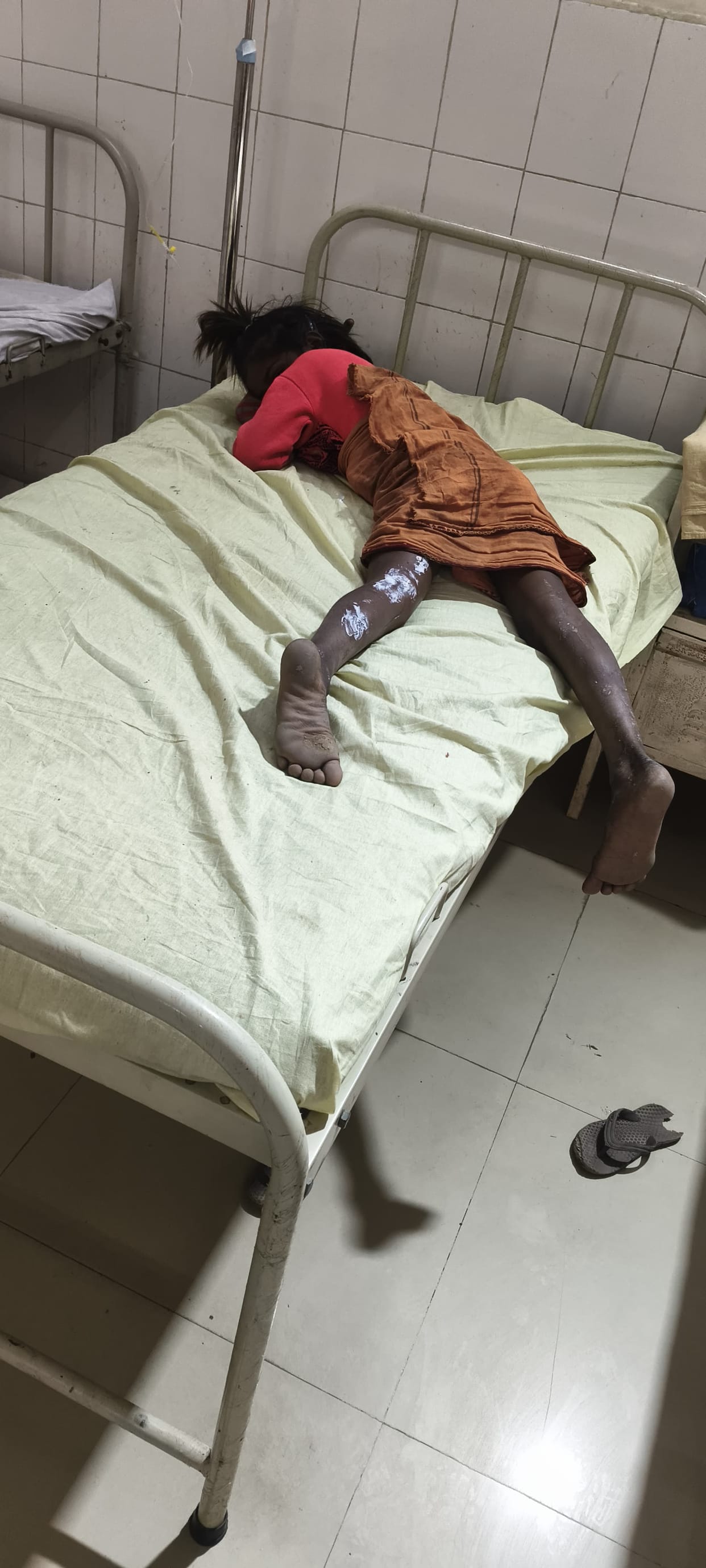 A pot of hot porridge spilled, and three girls were scalded.