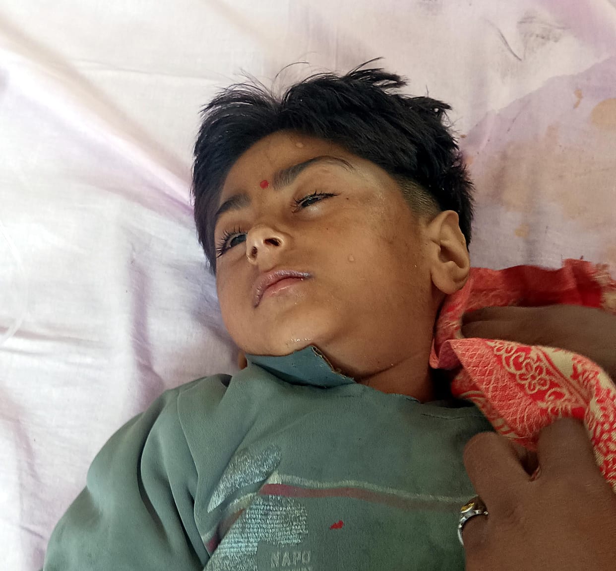 Girl injured after being crushed under door in monkey attack