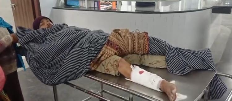 Munger News: हथियार के बल पर युवक की पिटाई, एक हाथ व पैर तोड़ा; जानें किस बात पर हुआ था दबंगों से यह विवाद